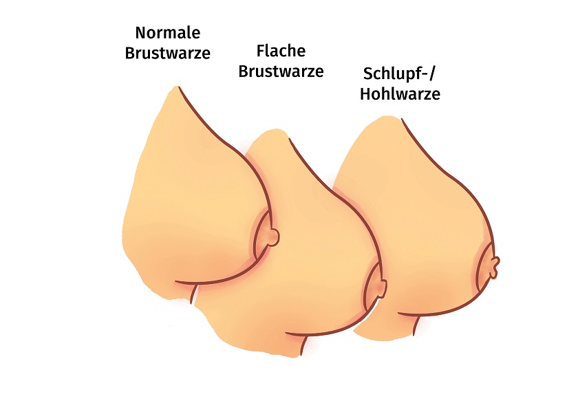 können_alle_ frauen_ stillen